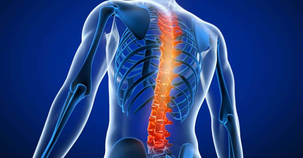 Campanha Julho Amarelo promove a conscientização sobre o câncer ósseo