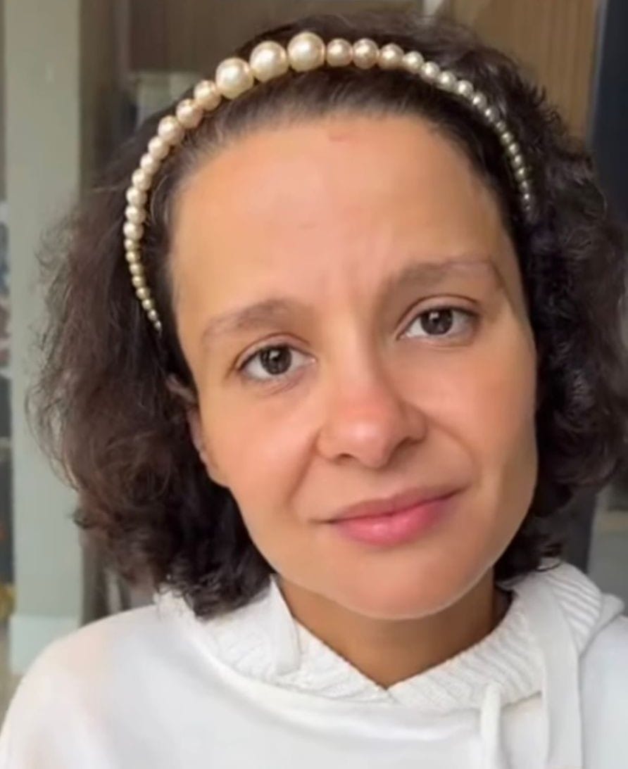 Maiara fala de diagnóstico de alopecia androgenética e chama atenção para a saúde capilar